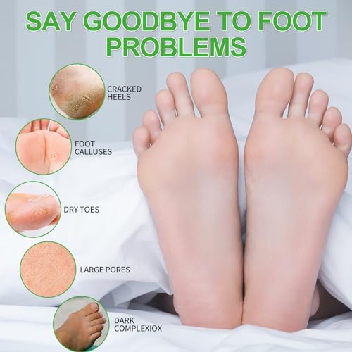 Pedicure Kit Foot Soak Set: Bubble Salt, Sugar Scrub, Massage Mask, Massage Lotion in a Box, 4 Step Foot Spa Kit for Dry Feet,Tired Feet(1 Set Lemon) - Image 2