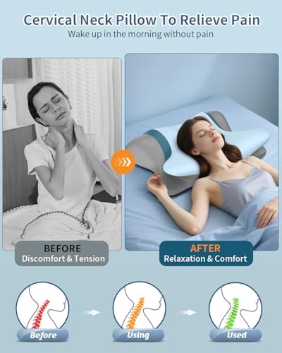 Cervical Neck Pillow for Pain Relief - Ergonomic Side Sleeper Pillow for Neck Support, Orthopedic Memory Foam Pillows for Sleeping, Contour Cervical Pillow Bed Pillow for Back Sleepers (Light Blue) - Image 2