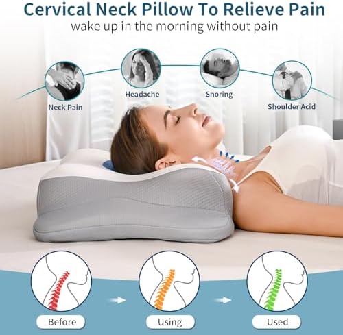Cervical Neck Pillow for Pain Relief - Ergonomic Side Sleeper Pillow for Sleeping, Cooling Memory Foam Pillows for Neck Support, Orthopedic Pillow Contour Bed Pillow for Back Sleepers (Blue&White) - Image 2