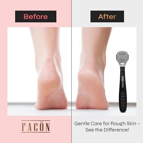 Facón Professional Callus Shaver Remover with 50 Blades, Pedicure Razor for Feet & Hands, Foot Razor for Callus Removal, Callus Blade Remover, Corn Shaver, Surgical Grade Premium Stainless Steel Tool - Image 3