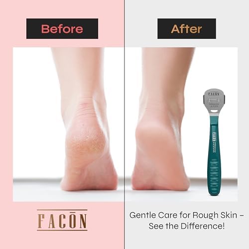 Facón Professional Callus Shaver Remover with 50 Blades, Pedicure Razor for Feet & Hands, Foot Razor for Callus Removal, Callus Blade Remover, Corn Shaver, Surgical Grade Premium Stainless Steel Tool - Image 3