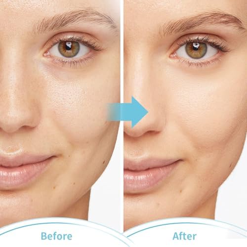 Cold Face Eye Masks Ice Face Mask Hot Cold Compress - Image 7