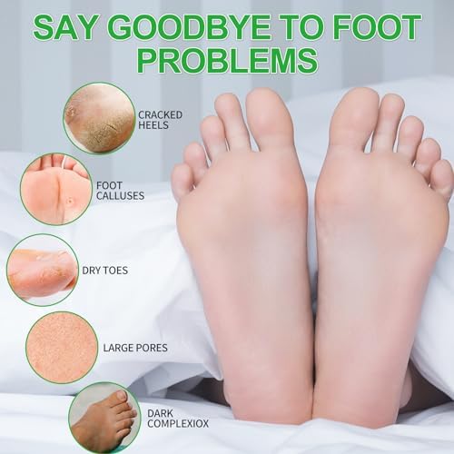 Pedicure Kit Foot Soak Set: Bubble Salt, Sugar Scrub, Massage Mask, Massage Lotion in a Box, 4 Step Foot Spa Kit for Dry Feet, Calluses and Tired Feet(3 Set Jasmine) - Image 2