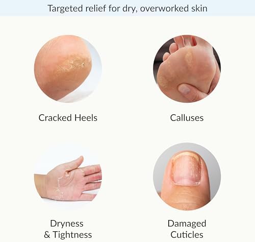 Epielle Intensive Repairing Hand & Foot Masks, Restore and Moisturize Dry, Cracked Skin, Self Care Gifts for Women, Spa Kit, 6 Moisturizing Gloves & 6 Moisturizing Socks - Image 4