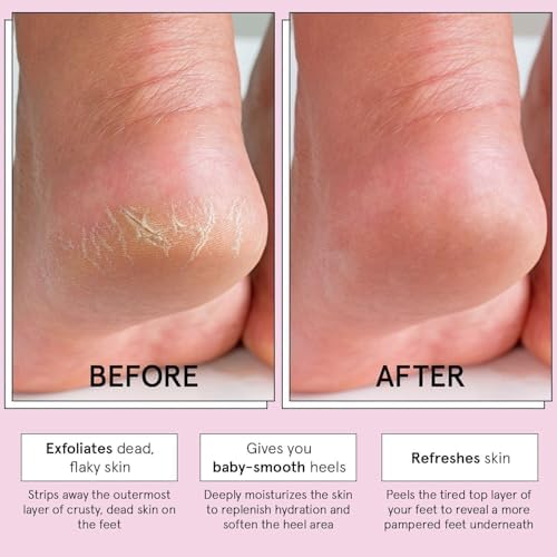 grace & stella Award-Winning Foot Peel Mask (4 Pairs, Lavender) - Image 3