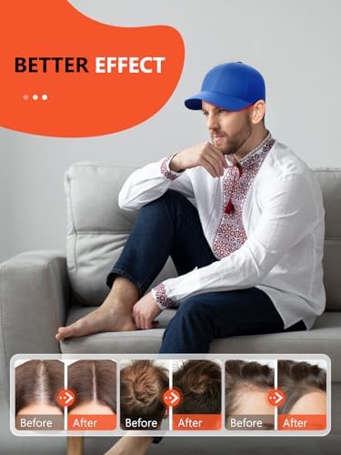 Red Light Hair Growth Cap, Red Light Therapy for Head, Red Infrared Light Therapy 660nm & 850nm & 940nm wavelength with Timer & Controller, Color: Blue - Image 2