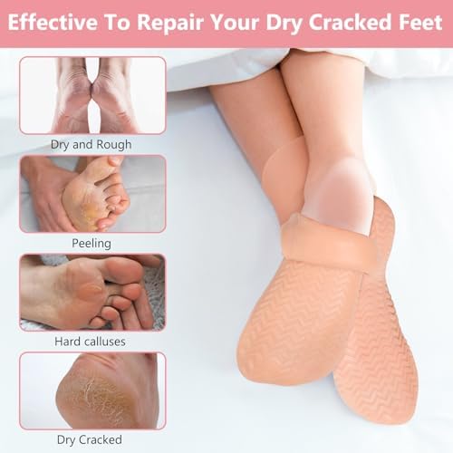 Silicone Moisturizing Socks for Dry Cracked Feet - 2 Pairs, XL Long Size, Non-Slip Heel Socks for Women and Men - High Stretch Foot Care Pedicure - White & Beige - Image 2