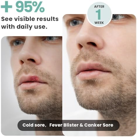 Red Light Therapy for Face, FSA-HSA Cold Sore Therapy Wand for Lips & Skin - Image 4
