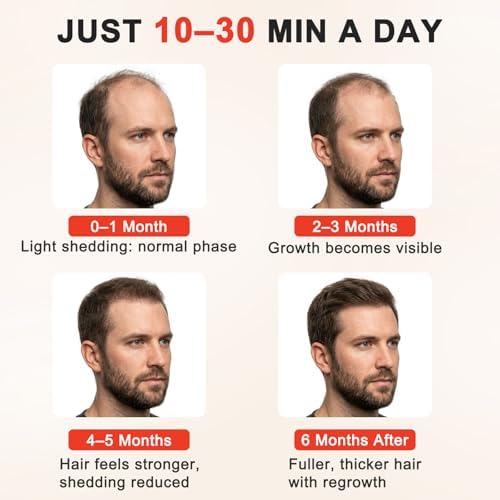 Red Light Hair Growth Cap - FDA Cleared Red Light Therapy for Hair Growth for Men & Women - Image 4