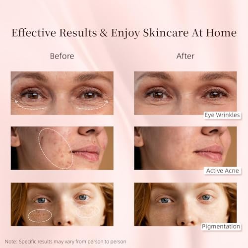 LED Face & Body Light Therapy Machine, 8 Colors, 287 LED Beads, Touch Control, White - Image 3
