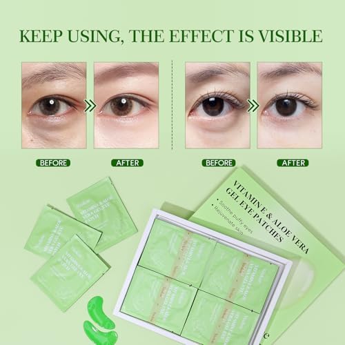 Yeokoe Under Eye Patches for Dark Circles,Puffy Eyes,20 Pairs Face Masks SkinCare With Vitamin E and Aloe Vera Gel for Rejuvenate - Image 4