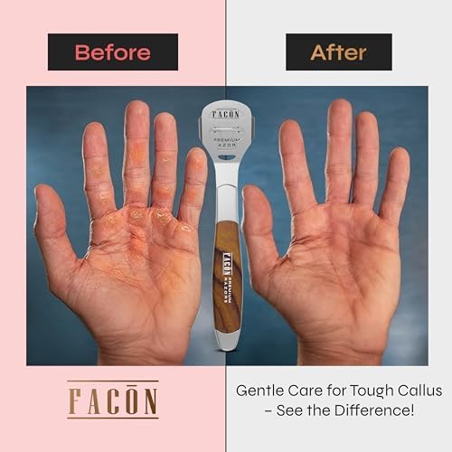 Facón Professional Callus Shaver Remover with 50 Blades, Pedicure Razor for Feet & Hands, Foot Razor for Callus Removal, Callus Blade Remover, Corn Shaver, Surgical Grade Premium Stainless Steel Tool - Image 4