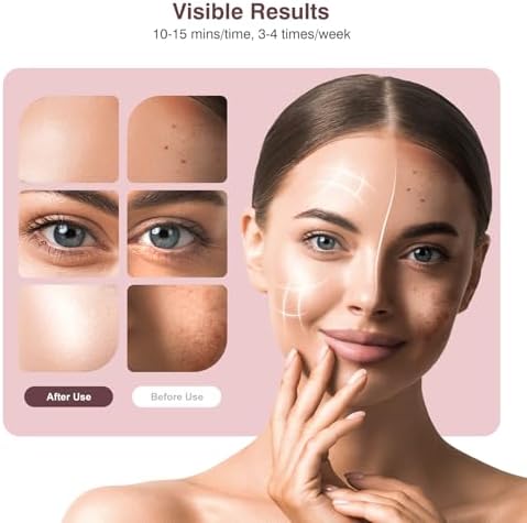 INTEO Red Light Therapy for Face, Red Light Therapy Mask, LED Face Mask - Image 5