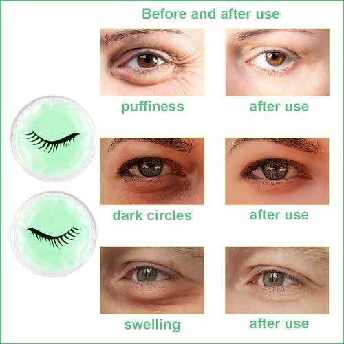 Face Eye Masks for Dark Circles and Puffiness, Migraines, Headache, Stress, Redness, Acne, Cooling Face Masks for Women Man, Hot Cold Use Ice Face Mask. (Green) - Image 6