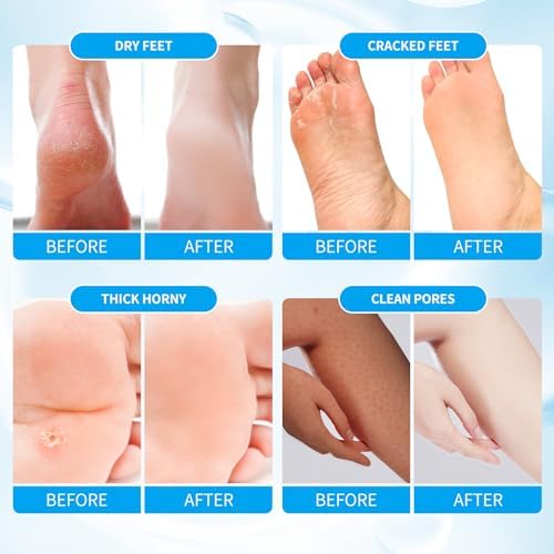 Pedicure Kit Foot Soak Set: Bubble Salt, Sugar Scrub, Massage Mask, Massage Lotion in a Box, 4 Step Foot Spa Kit for Dry Feet, Softens Calluses(1 Set Pacific Waves) - Image 2