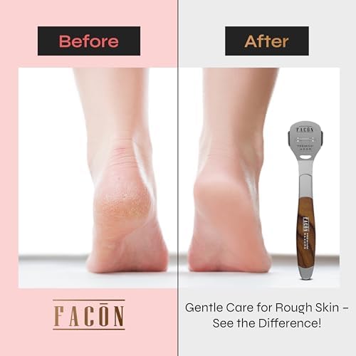 Facón Professional Callus Shaver Remover with 50 Blades, Pedicure Razor for Feet & Hands, Foot Razor for Callus Removal, Callus Blade Remover, Corn Shaver, Surgical Grade Premium Stainless Steel Tool - Image 3