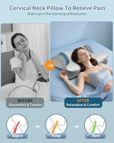 Cervical Pillow for Neck Pain Relief, Ergonomic Neck Pillow for Sleeping, Orthopedic Contour Side Sleeper Pillow for Neck Support, Cooling Memory Foam Pillows for Back Stomach Sleepers - Image 2