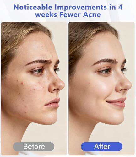 LED Light Therapy Machine FDA Cleared Red, Infrared and Blue Light Therapy, LED Face Mask Light Therapy Skin Care Photon Device for Wrinkle Reduction and Acne, G3 - Image 3