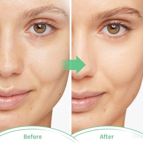 Cold Face Eye Masks Ice Face Mask Hot Cold Compress - Image 7