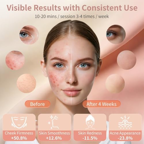 Red Light Therapy Face for Mask, 850nm NIR, Red & Blue for Home Skincare - Image 2