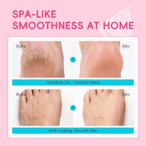 QUIYUM 6 Pairs Watermelon Foot Mask, Moisturizing Booties for Dry Skin - Image 6