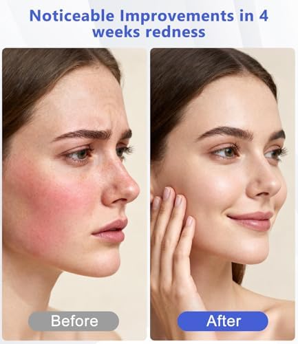 LED Light Therapy Machine FDA Cleared Red, Infrared and Blue Light Therapy, LED Face Mask Light Therapy Skin Care Photon Device for Wrinkle Reduction and Acne, G3 - Image 4