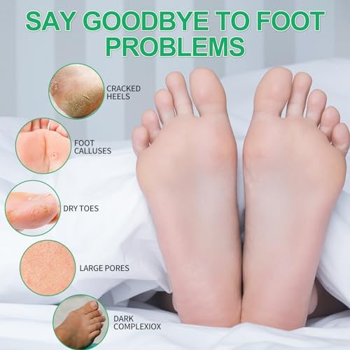 Pedicure Kit Foot Soak Set: Bubble Salt, Sugar Scrub, Massage Mask, Massage Lotion in a Box, 4 Step Foot Spa Kit for Dry Feet,Tired Feet（3 Set Eucalyptus) - Image 2
