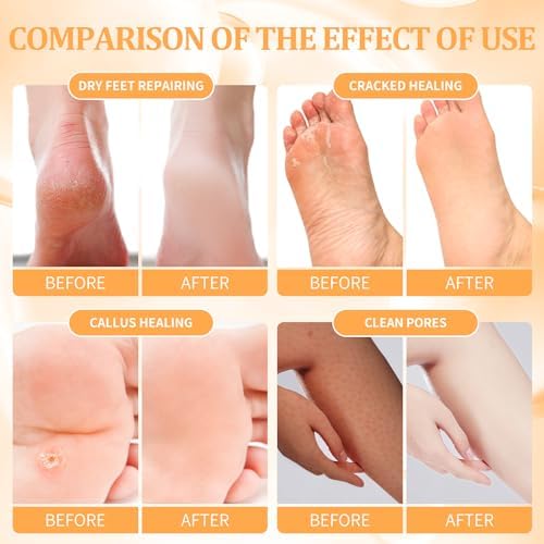 Foot Pedicure Spa Set,Foot Soak Spa Home Pedicure Kit with Bath Salt, Moisturizing Foot Scrub Cream Lotion, Foot Care for Dead Skin, Dry Cracked Feet, Make Baby Soft Feet, 3 Set - Image 3
