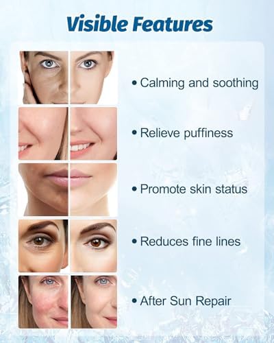 Ice Roller for Face & Eyes - Eye Roller for Cooling & Morning Depuffing, Face Ice Press for Migraine Relief&Eye Bags,Women Skin-Refresh Tool&Hygienic Storage (2pcs) - Image 3