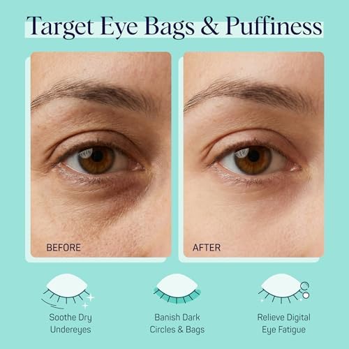 SpaLife Cooling Cucumber Eye Pads | Spa Gifts & Korean Dark Circles & Puffy Eyes Treatment | Nourishing Cucumber Eye Pads | Eye Mask for Puffy Eyes Daily Depuffing Eye Patches | 4 Packs of 12 - Image 2