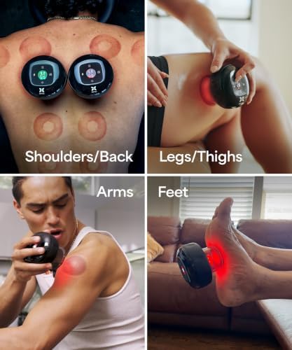 REVO The Original 4-in-1 Smart Cupping Massager with LED Light, Heat, Dynamic Suction & Vibration Massage, Portable Cordless Rechargeable Cupping Device for Body- 1 Pack - Image 6