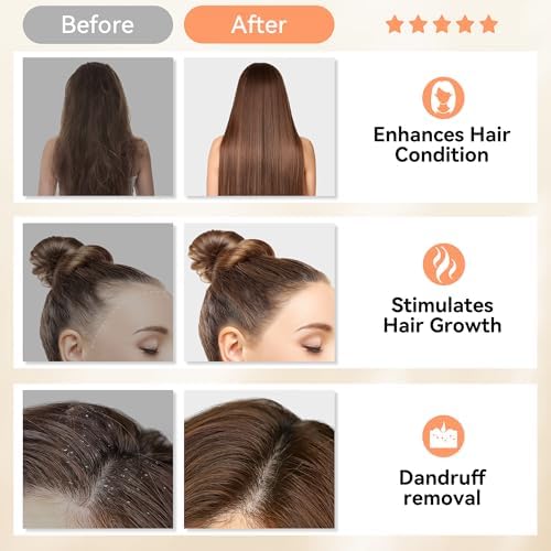 HEETA Scalp Massager Hair Growth Scrubber for Dandruff Removal Hair Care - Image 6