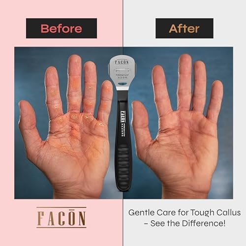 Facón Professional Callus Shaver Remover with 50 Blades, Pedicure Razor for Feet & Hands, Foot Razor for Callus Removal, Callus Blade Remover, Corn Shaver, Surgical Grade Premium Stainless Steel Tool - Image 4