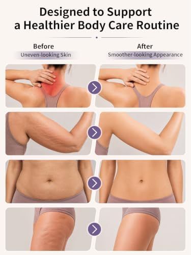 Cupping Massager for Body with Lymphatic Drainage, Heat & Rolling Massage-B - Image 3