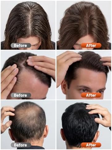 RELEXNOW Red Light Therapy Cap for Hair with Upgraded 180 Tri-Chip LEDs - Image 2