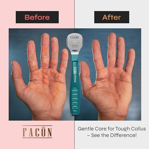Facón Professional Callus Shaver Remover with 50 Blades, Pedicure Razor for Feet & Hands, Foot Razor for Callus Removal, Callus Blade Remover, Corn Shaver, Surgical Grade Premium Stainless Steel Tool - Image 4