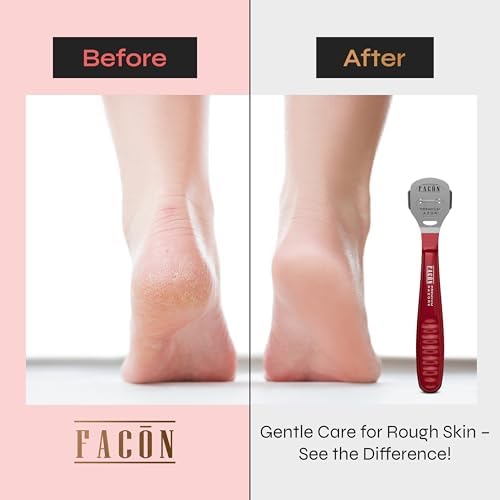 Facón Professional Callus Shaver Remover with 50 Blades, Pedicure Razor for Feet & Hands, Foot Razor for Callus Removal, Callus Blade Remover, Corn Shaver, Surgical Grade Premium Stainless Steel Tool - Image 3