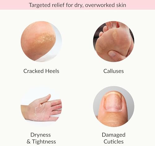 Epielle Moisturizing Hand & Foot Masks, Soften Dry Skin with Sunflower Seed Oil & Vitamin E, Self Care Gifts for Women, Spa Kit, 6 Moisturizing Gloves & 6 Moisturizing Socks - Image 4