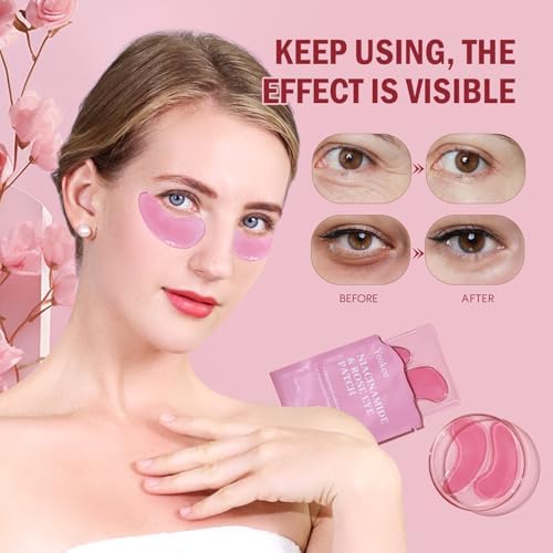 Yeokoe Under Eye Patches for Dark Circles,Puffy Eyes,20 Pairs Face Masks SkinCare With Niacinamide and Rose for Rehydrated - Image 4