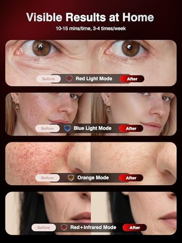 4D Wireless Red Light Therapy LED Face Mask with 328 LEDs - Image 4