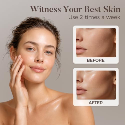 Nano Ionic Facial Steamer Kit with 17 Skin Care Tools for Home Spa - Image 5