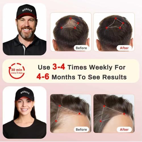Red Light Hair Growth Cap, 528 Total Light Emitters, Red Light Therapy for Hair,Adjustable Fit,At-Home Sessions for Men & Women, Irradiation Aesthetic - Image 5