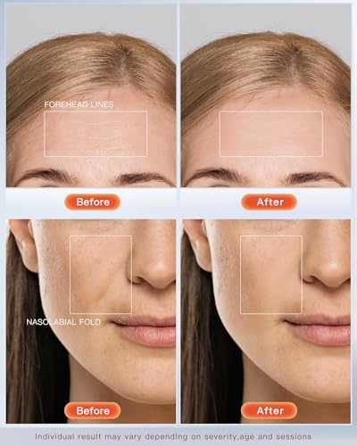 NEWKEY 4D LED Red Light Therapy Mask for Face Skin Glowing,630nm Led Light Therapy Face Mask Anti Wrinkle, Blue Light Therapy Face Mask for Acne,Home use,450 LED Chips,Birthday gift,Plug in - Image 2