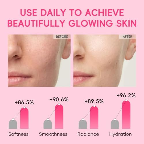 QUIYUM 14 Pack Watermelon Niacinamide Sheet Mask - Hydrating Facial Masks - Image 6