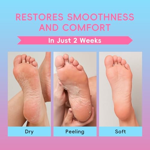 QUIYUM 6 Pairs Peach & Aloe Vera Exfoliating Foot Mask, Foot Peeling Masks - Image 3