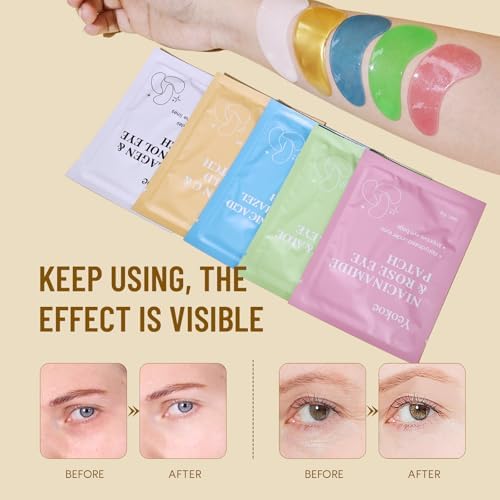 Yeokoe Under Eye Patches for Dark Circles,Eye Mask for Puffy Eyes With Collagen,Retinol,Vitmin C,Hyaluronic Acid and Niacinamide Face Masks Skincare Spa Gifts for Woman 20Pairs - Image 4