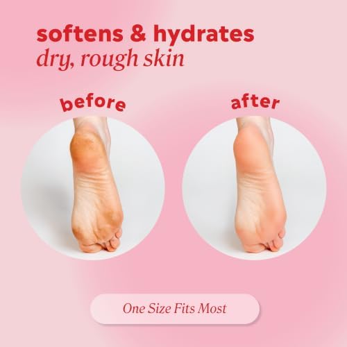 Onyx Professional Gel Moisturizing Socks, One Size Dry Feet Treatment for Women or Men, Hydrating Spa Socks for Dry Feet and Cracked Heel Repair, One Reusable Pair - Image 4
