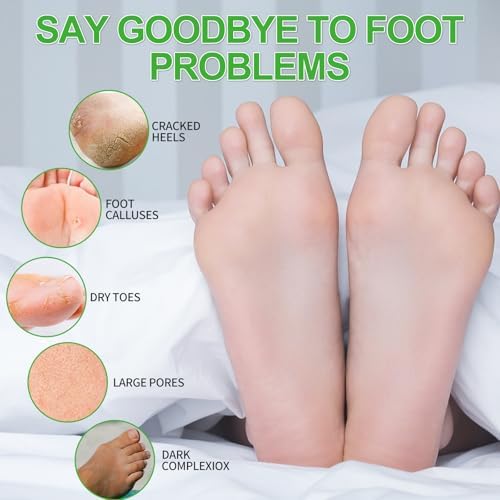 Pedicure Kit Foot Soak Set: Bubble Salt, Sugar Scrub, Massage Mask, Massage Lotion in a Box, 4 Step Foot Spa Kit for Dry Feet, Calluses and Tired Feet（3 Set Peppermint） - Image 2