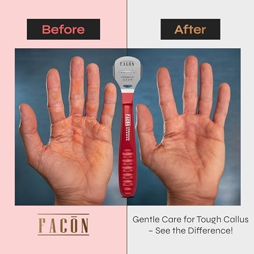 Facón Professional Callus Shaver Remover with 50 Blades, Pedicure Razor for Feet & Hands, Foot Razor for Callus Removal, Callus Blade Remover, Corn Shaver, Surgical Grade Premium Stainless Steel Tool - Image 4
