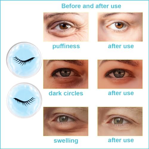 Cold Face Eye Masks Ice Face Mask Hot Cold Compress - Image 6